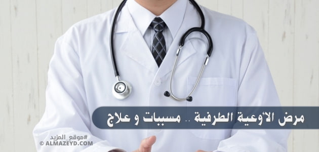 مرض الأوعية الطرفية .. مسببات وعلاج